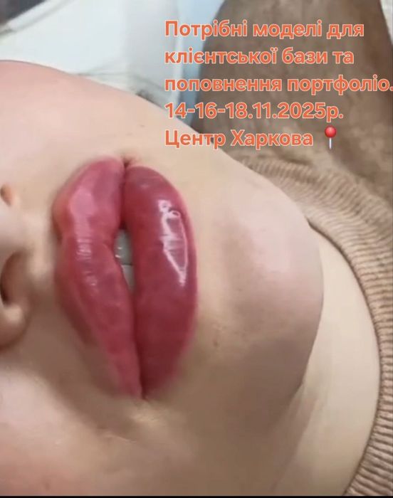 Косметолог/Ботокс/Збільшення губ/МОДЕЛІ