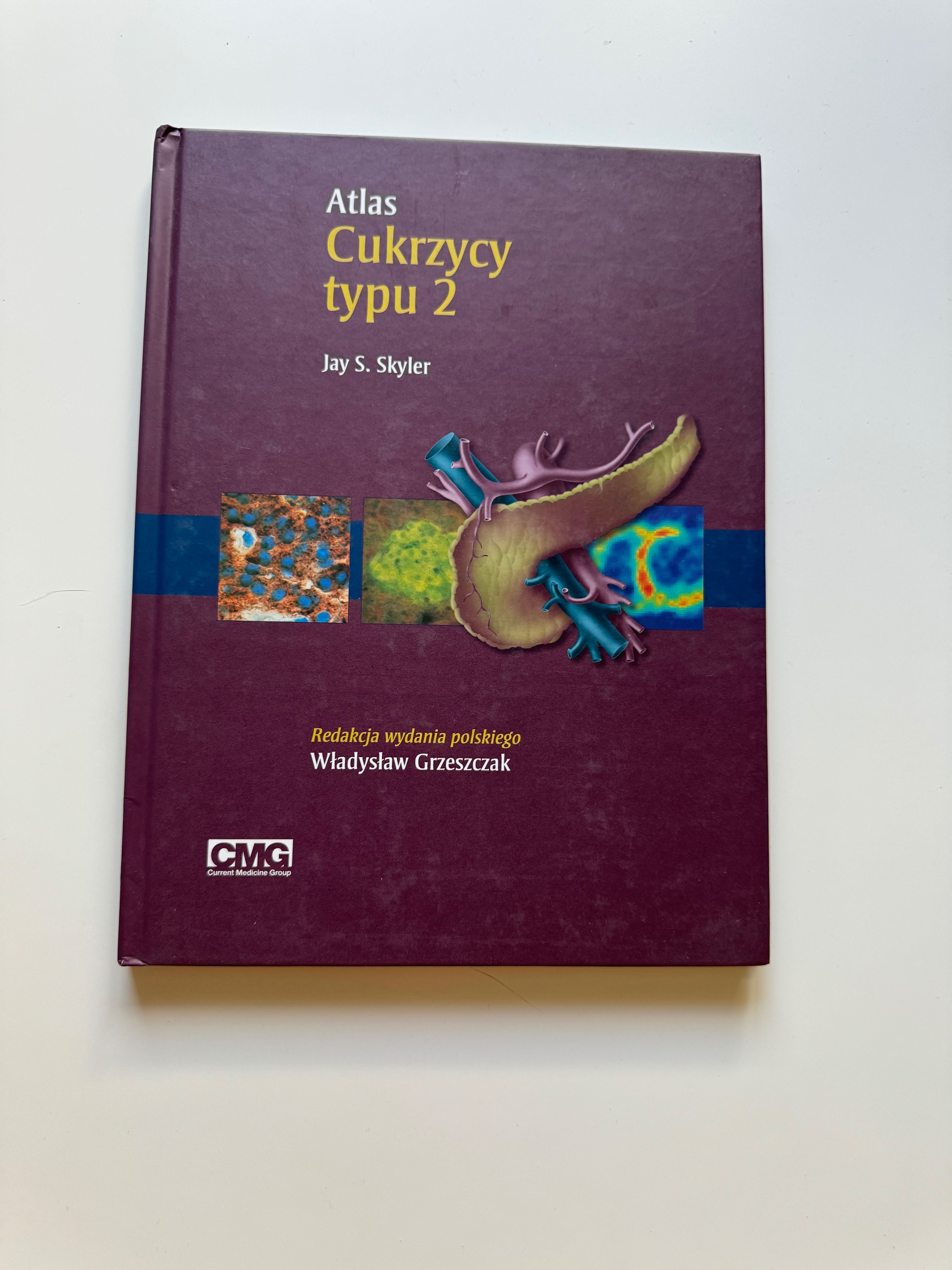 Atlas Cukrzycy typu 2 Jay S. Skyler