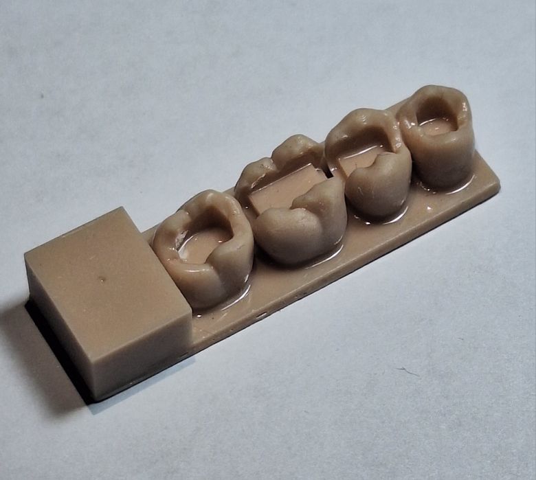 Нова 3D-модель для покращення навику прямої реставрації, фантом