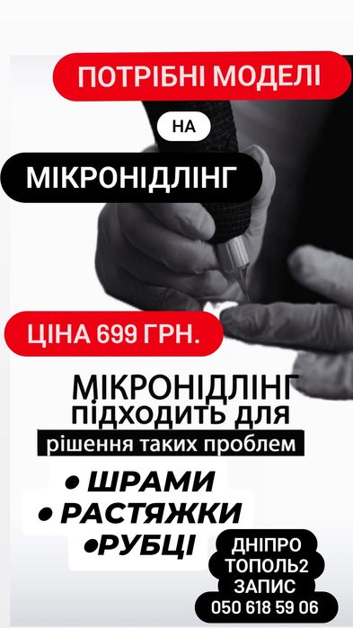 МІКРОНІДЛІНГ ВИДАЛЕННЯ Растяжек/Рубців/Шрамів/Татуажу/Дніпро /ТОПОЛЬ 2