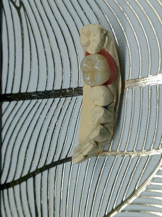 Зуботехнічна лабораторія Stom-tex zt  , пропонує співпрацю лікарям