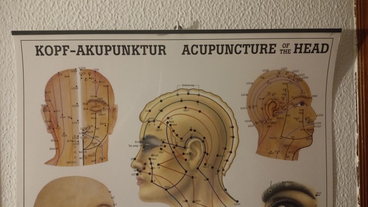 Poster de Acupuntura