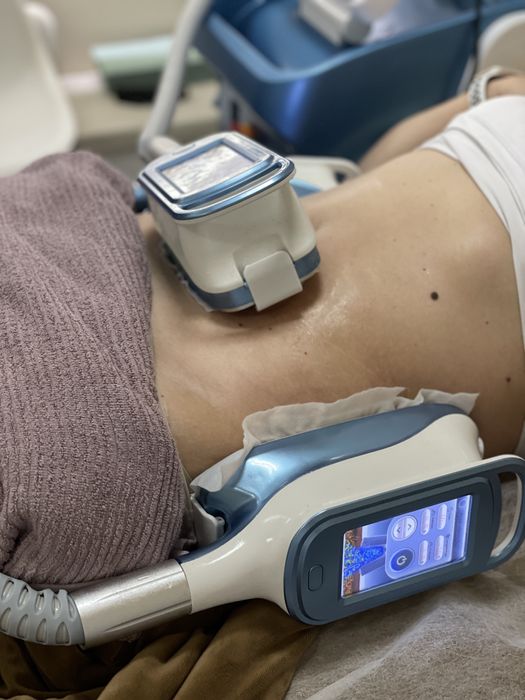 Кріоліполіз, кавітація, обгортання, ролик