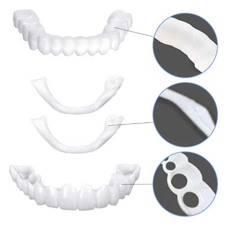 Вініри Snap-On Smile, капа, вставні зуби, не помітні для оточуючих