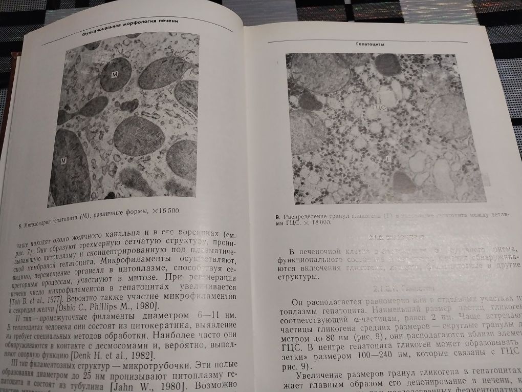 Книга Морфологическая диагностика заболеваний печени