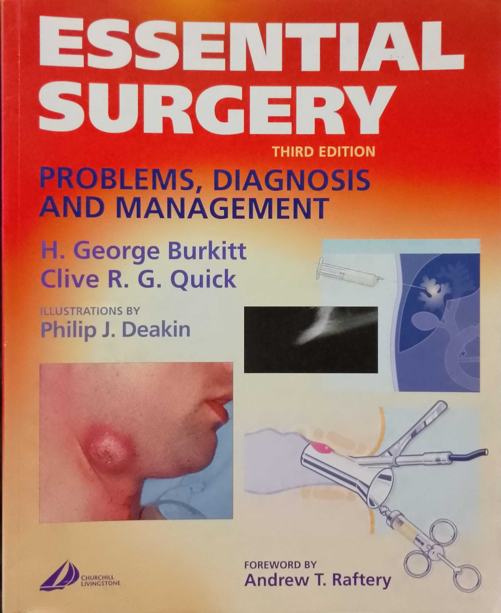 Essential Surgery : Problems, Diagnosis and Management