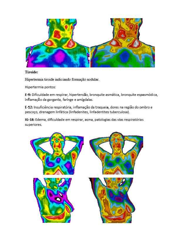 Seja Especialista em Termografia  e Transforme Sua Carreira na Saúde!