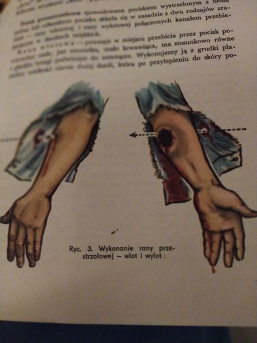 Instrukcja pozorowanie zranień i innych urazów obrona cywilna