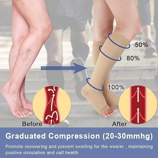 Medyczne pończochy uciskowe, 20-30 mmHg, roam. M, beżowe