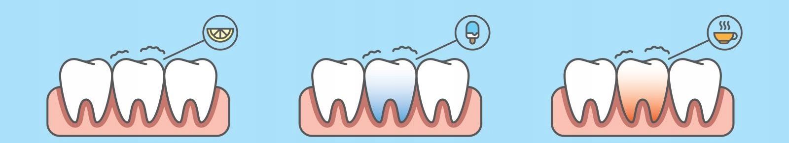 Pasta Do Zębów Blanx Sensitive Wrażliwe Zęby 75 Ml
