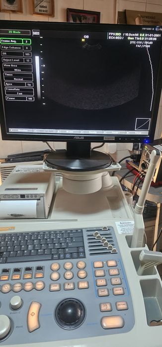 УЗД апарат SONOACE SA-8000 Livе