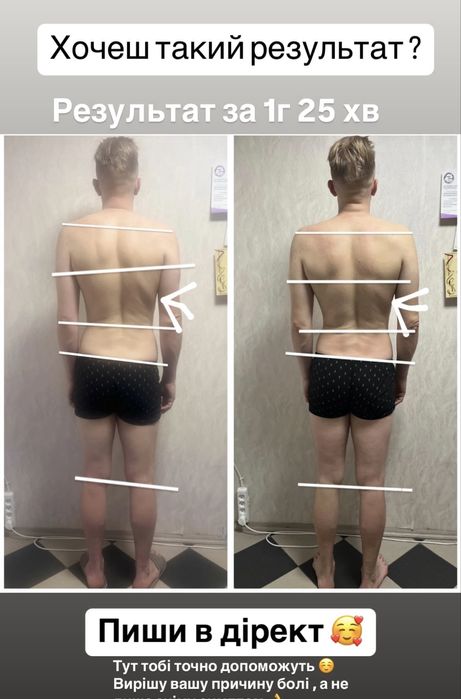 Масажист реабілітолог