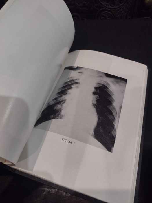 O Lugar da Gentamicina na Antibioticoterapia Actual