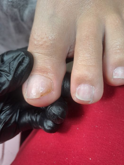 Апаратний педикюр з основами подології в місті СУМИ