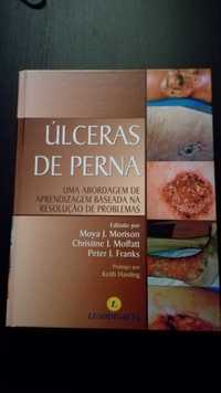 Livro Úlceras de Pernas