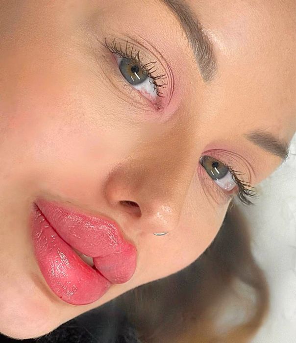 Косметолог Николаев ,губы 3500,ботокс биоревитализация