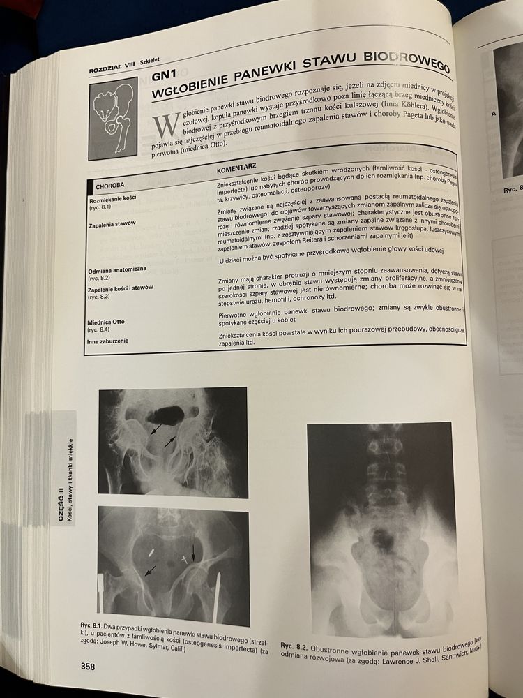 Radiologia kliniczna Marchiori