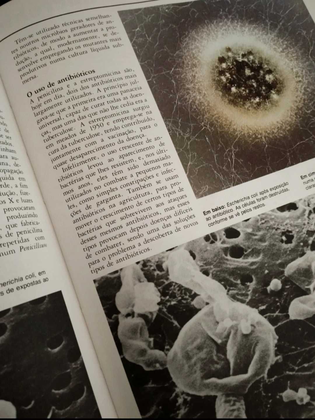 Livro "Micróbios" 1985