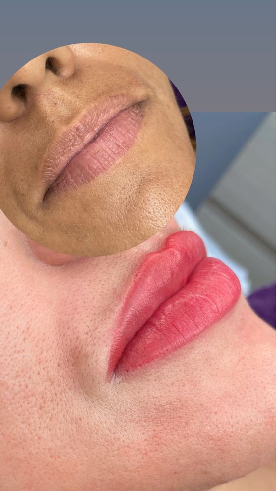 Micropigmentaçāo labial