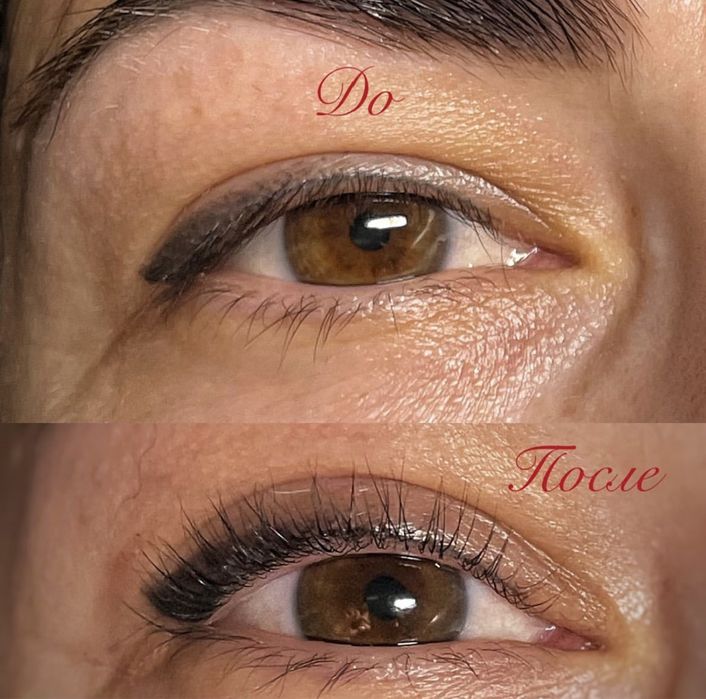 Наращивание, ЛаминированиеМасельского Хтз