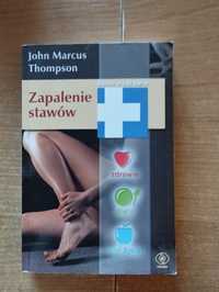 Zapalenie stawów John Marcus Thompson