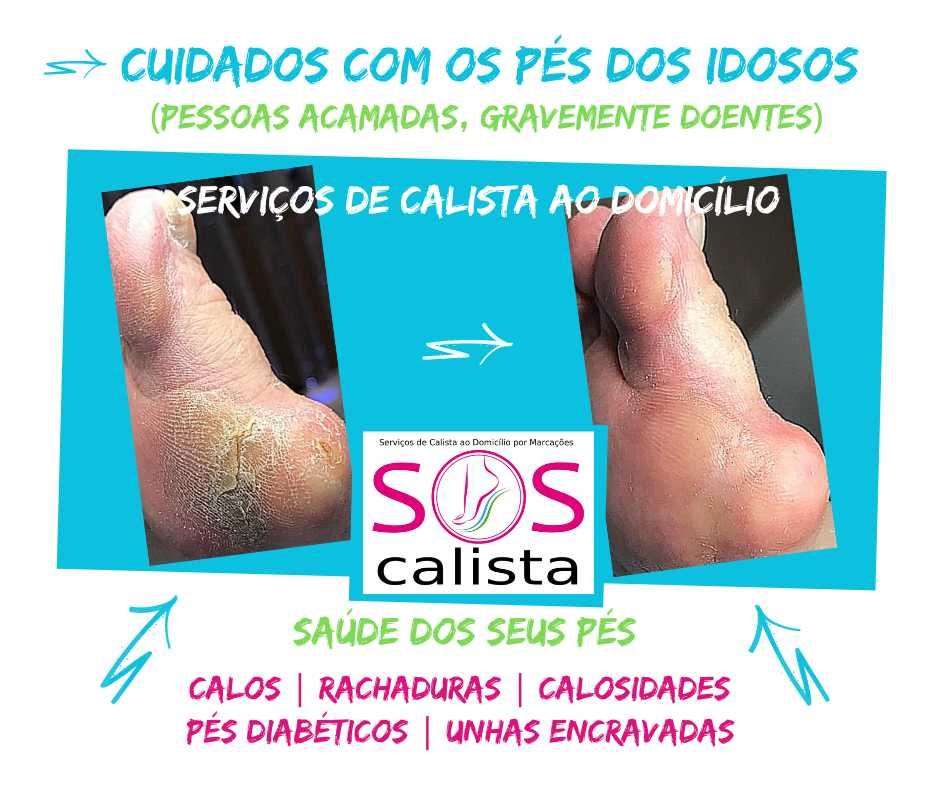 Calista ao Domicílio ou no Gabinete (Benfica)