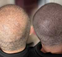 Перманент волос трихопигментация мужчины и женщины