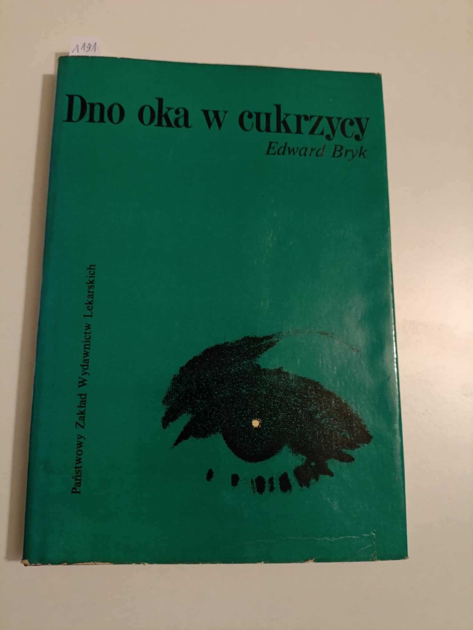 Dno oka w cukrzycy - Edward Bryk