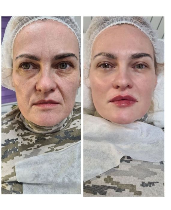 Косметолог Мукачево , по доступним цінам