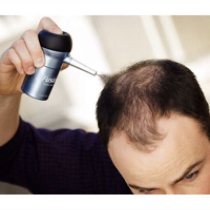 Fibras Toppik para calvície instantâneo