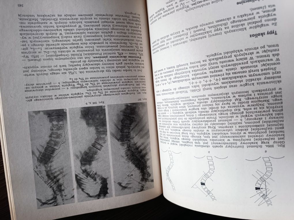 Książka Rehabilitacja medyczna. Dega, Milanowska.Rok 1983