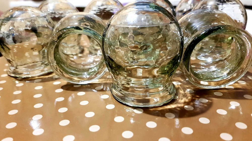 Набор медицинских вакуумных банок