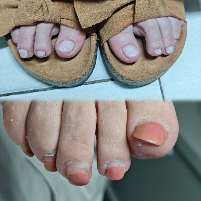 Serviço de pedicure e calista ao domicílio