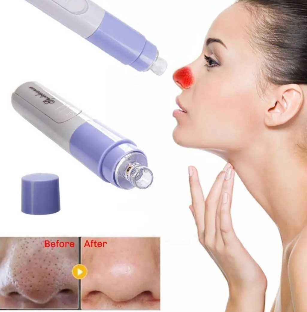 Вакуумний очищувач Pore Cleanser Skin Cleaner для обличчя шкіри пор