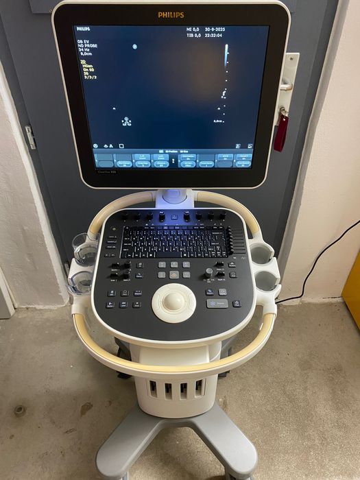 УЗД (УЗИ) Philips Clearview 550 2019 р.в.