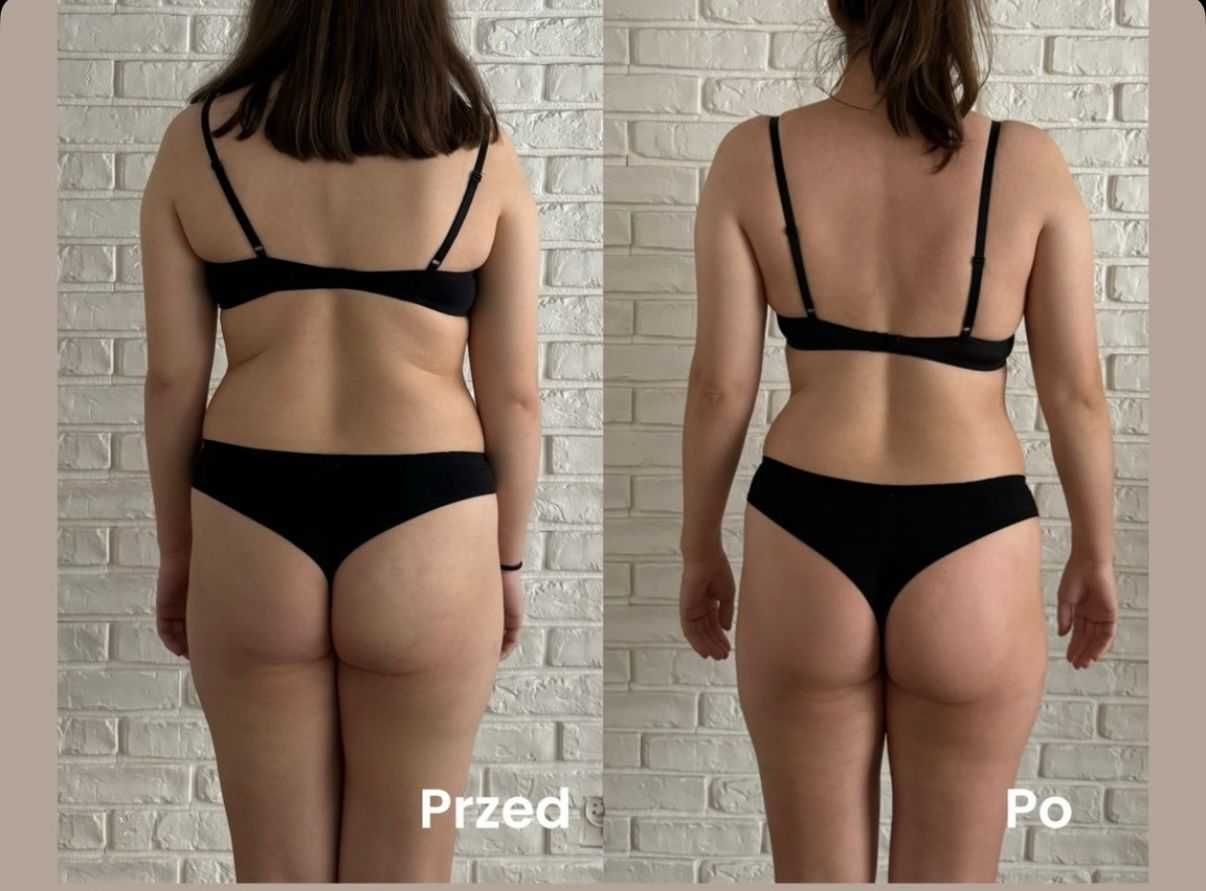 Urządzenie do masażu modelującego sylwetkę Vela Shape