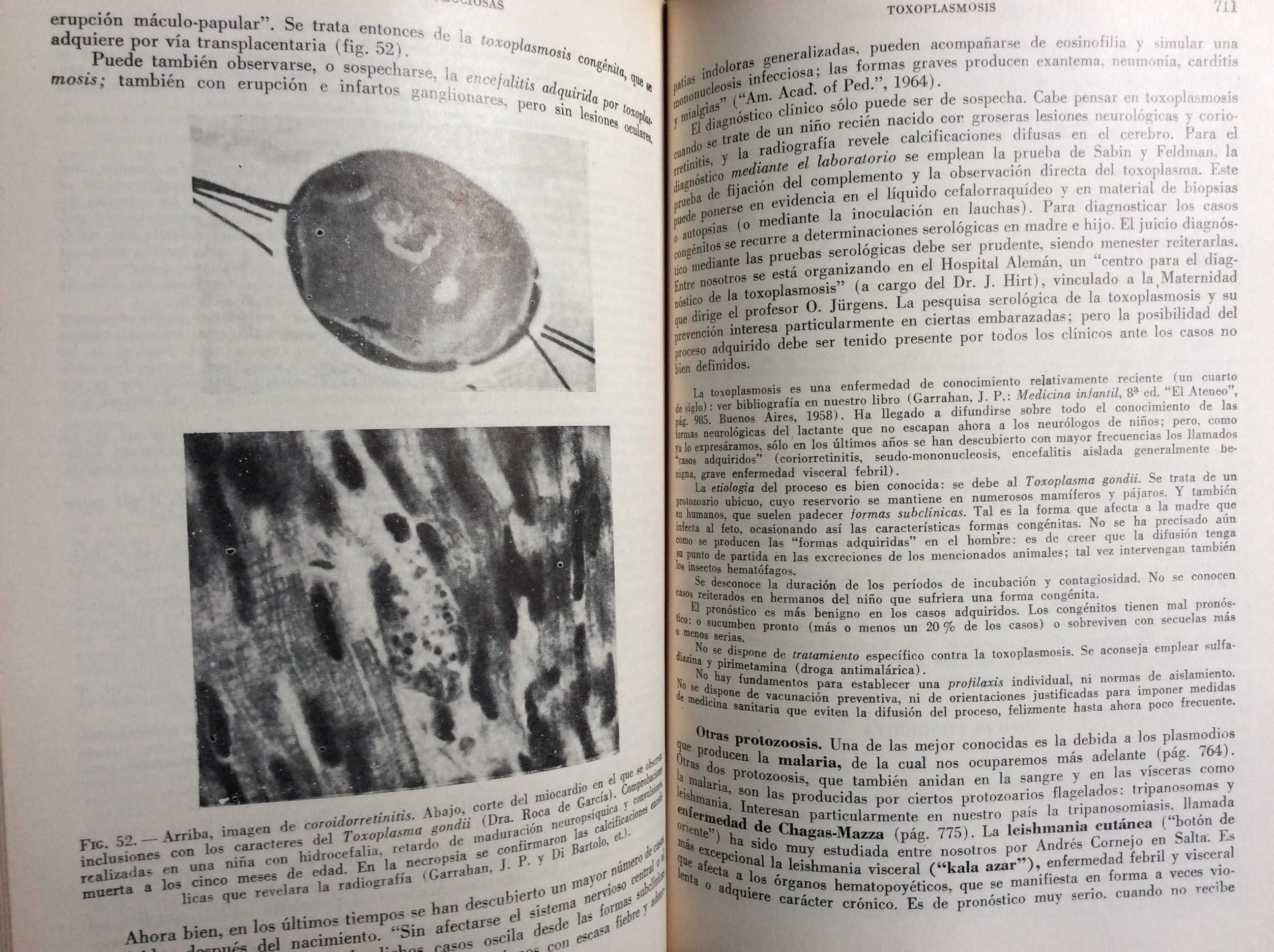 Pediatría Y Puericultura. Por Juan P. Garraham, 1966