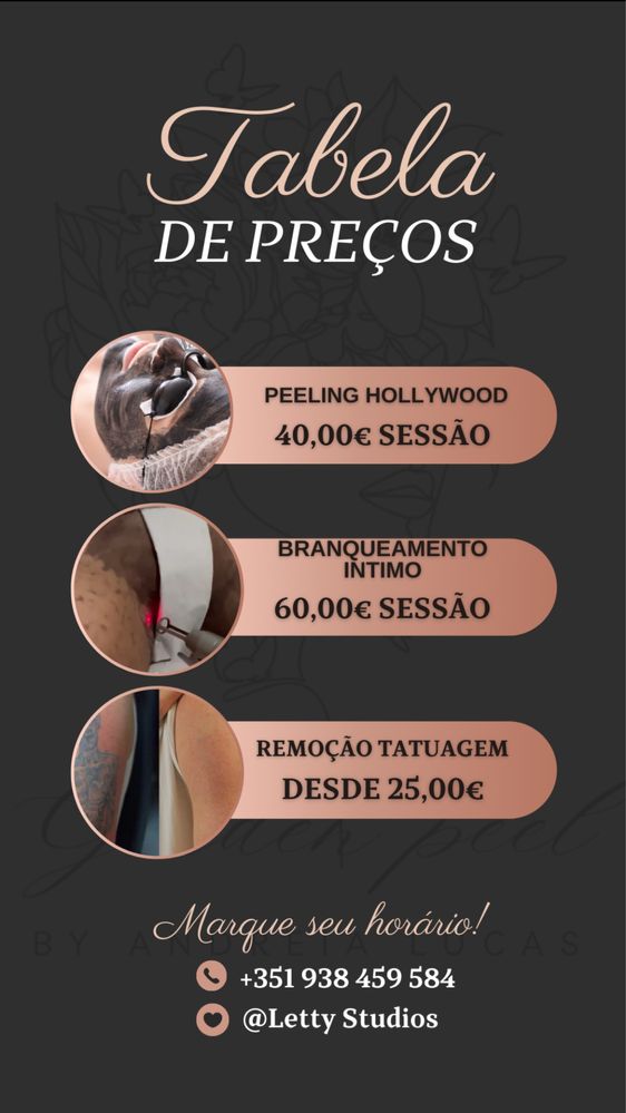 Tecnica de remocao de tatuagem, branqueamento intimo e peeling