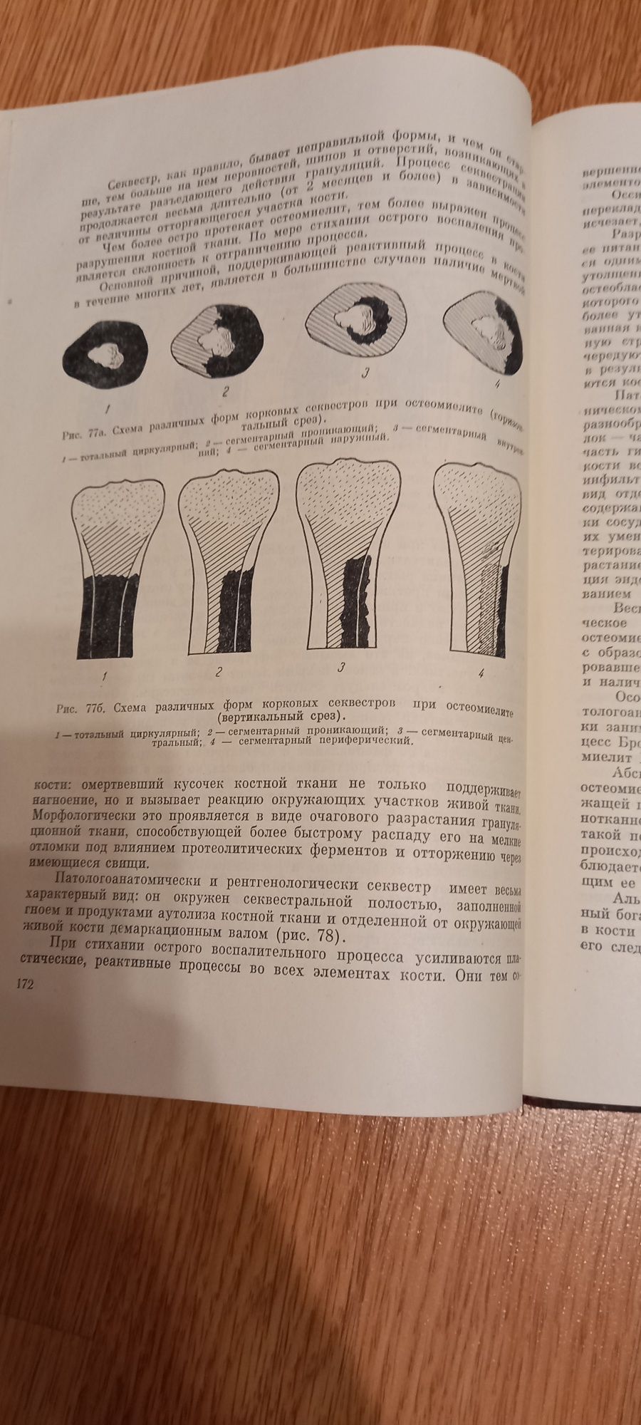 Гнойная хирургия авт. Стручков