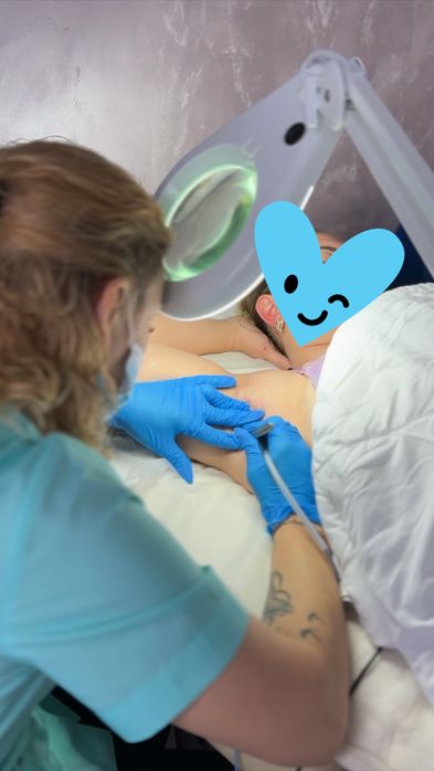 Електроепіляція саме для тебе