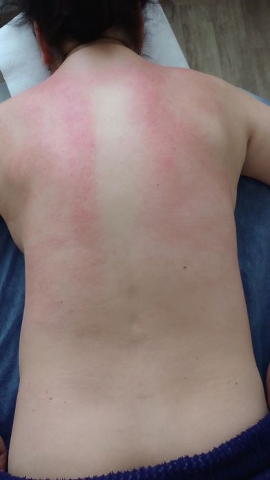 Лікувальний терапевтичний масаж для дітей і дорослих