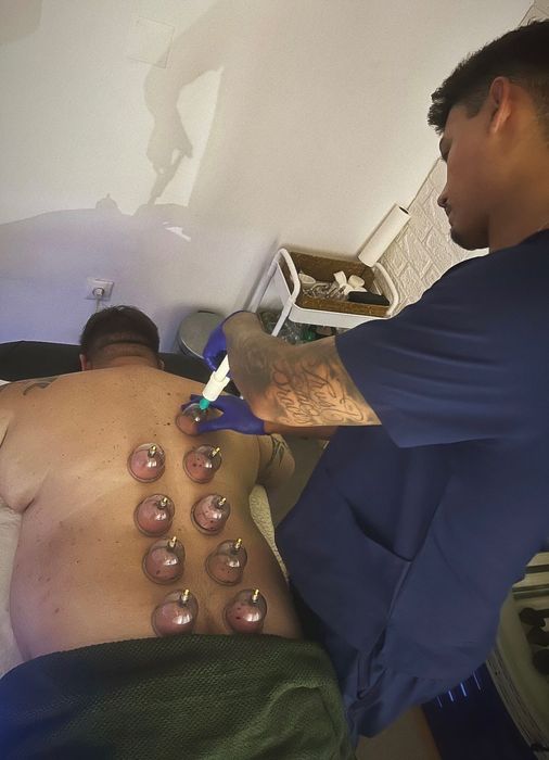 Massoterapeuta e depilação a laser