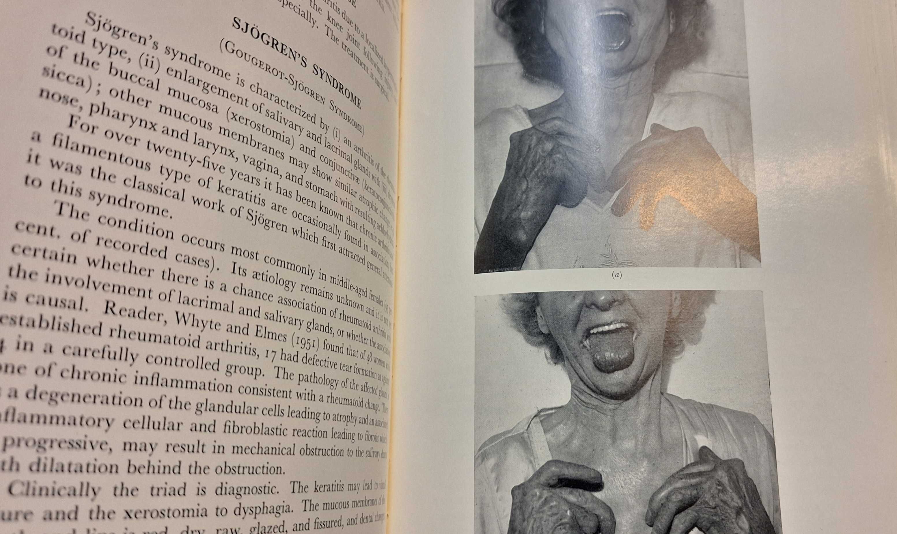 Medicina - Doenças Reumáticas