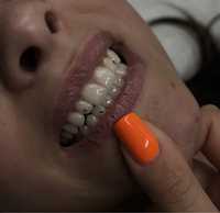 Tooth gems uśmiech z kryształkami