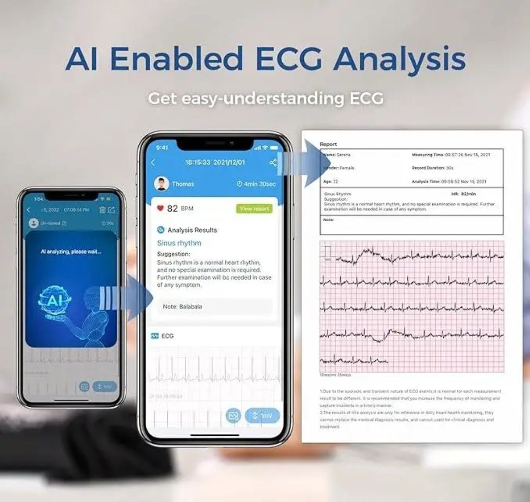Тонометр Wellue, Viatom-Blood Pressure Monitor With ECG BP2 Монітор ар