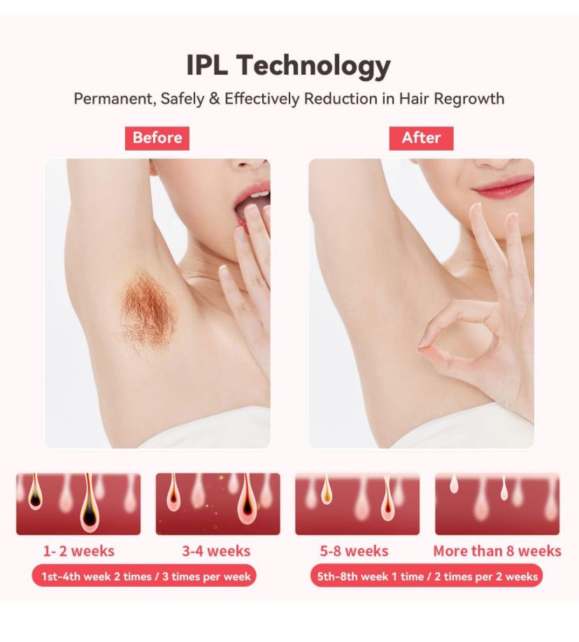 Laser LOVEDOCK D-1155 IPL do usuwania włosów z funkcją chłodzenia