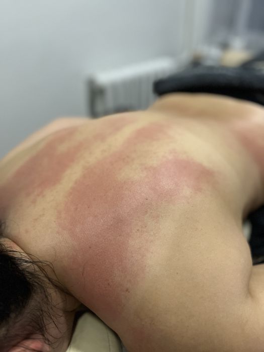 Пресотерапія, ліпопластика, лімфодренаж, кавітація  , масаж