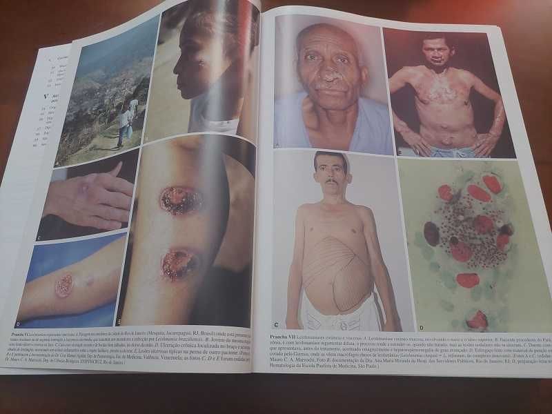 Livro Técnico em Português "Parasitologia", Luis Rey - 3ª Edição