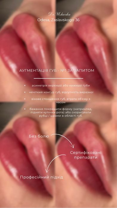 Модель на контурна пластика Губ/збільшення губ|Ботокс|Косметолог Одеса