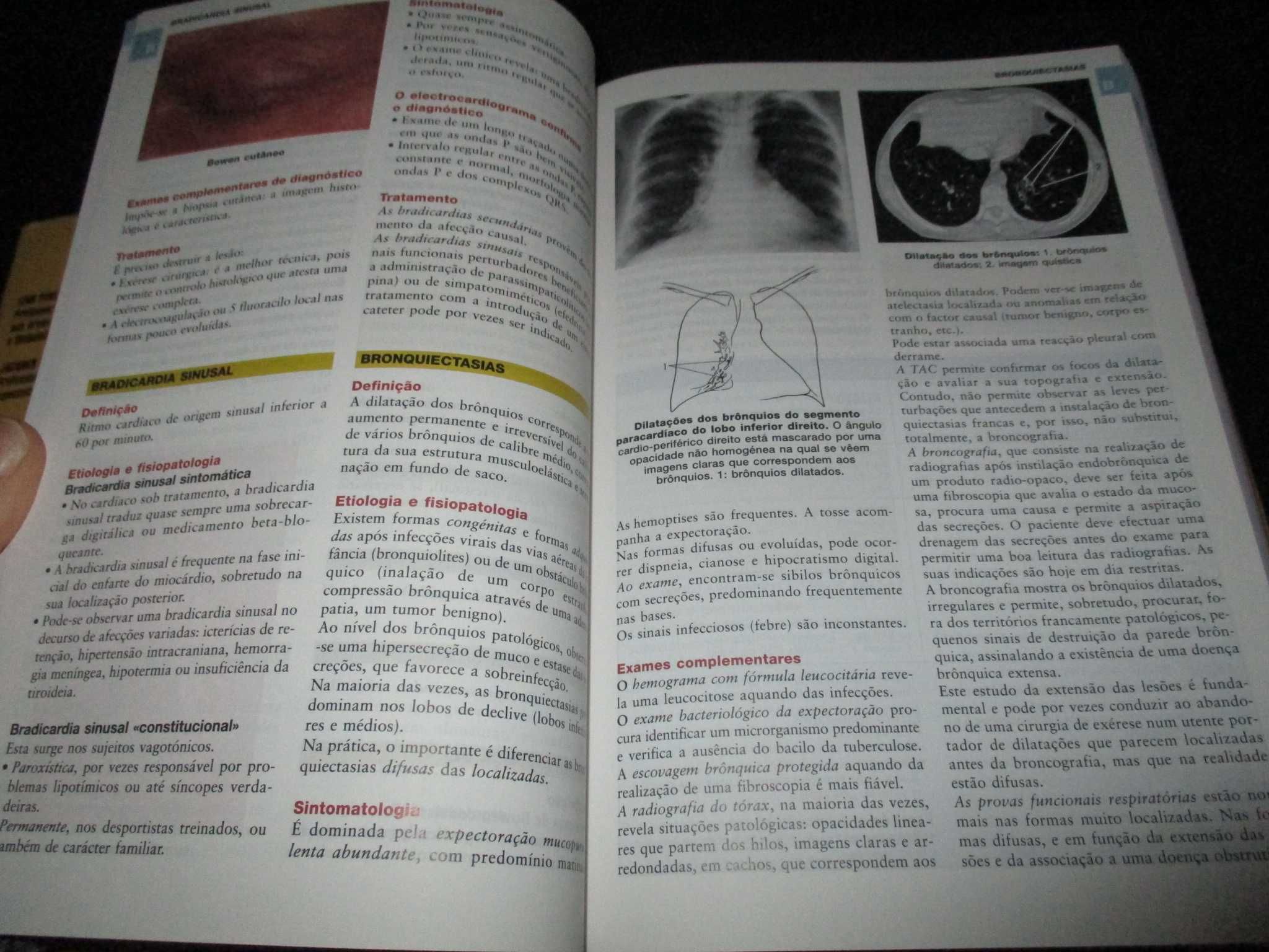 Livro Dicionário Ilustrado de Medicina Jacques Quevauvilliers Climepsi